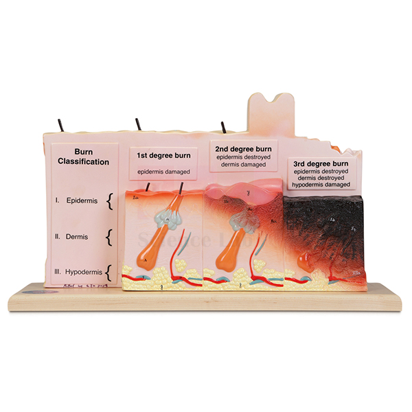 Human Skin with Burn Pathologies Model